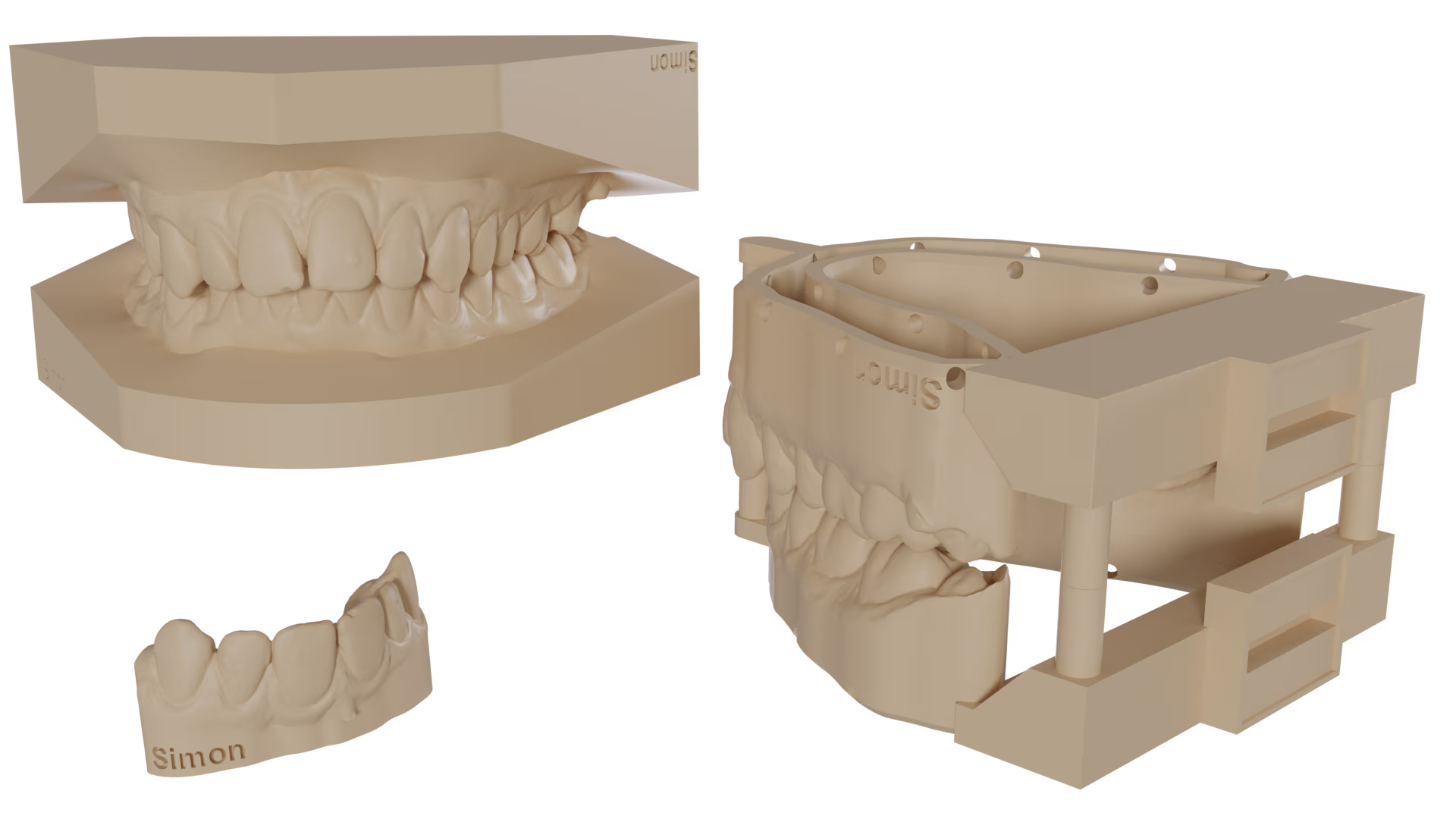 AI-generated orthodontic models, print-ready