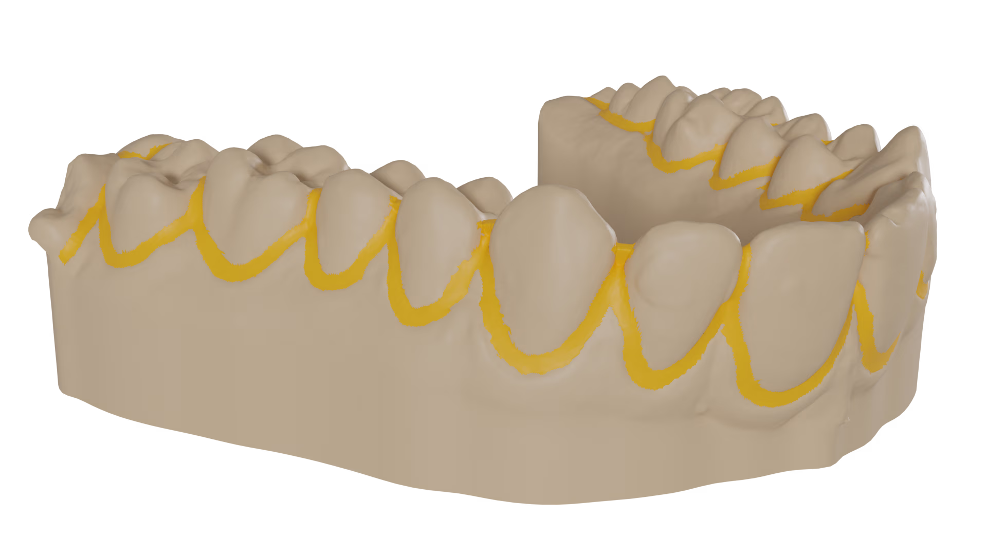 Print-ready retainer models